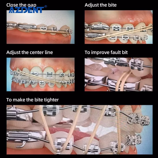 Best Selling Dental Orthodontic Elastic Band Different Models